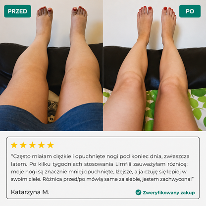 LIMFIA - DRENAŻ LIMFATYCZNY